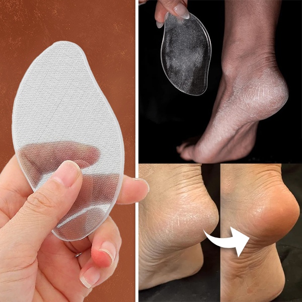 Klaasist jalgade viil | PEDIGLASS