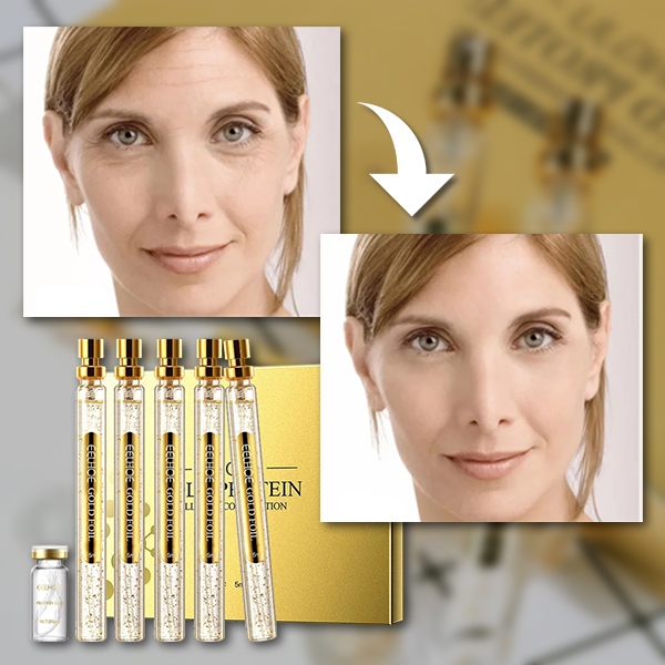 Proteiini nahahooldusseerumite komplekt | PROLIFT