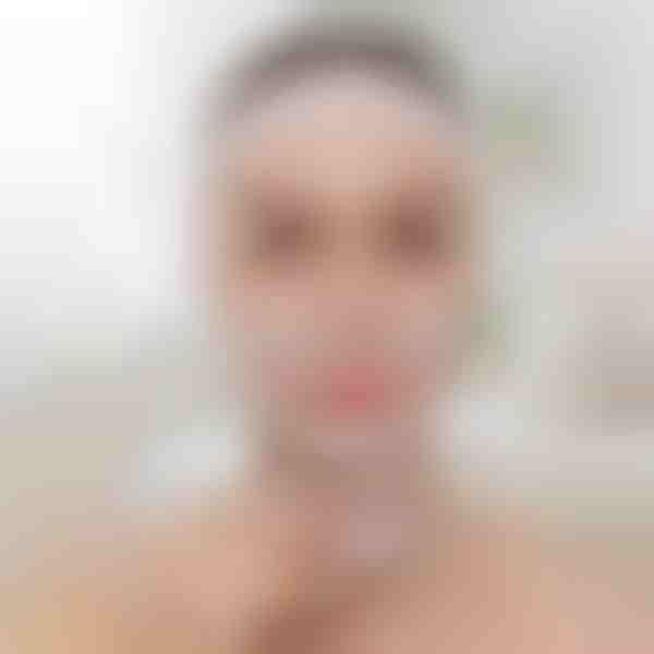 Näo vormiv tõstev tugiside | KIMLIFT