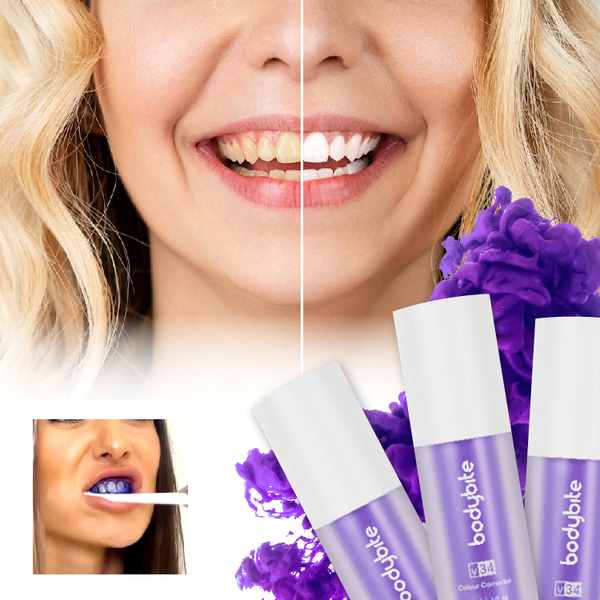 JOYTEETH_14.09.23_LILJANA_UPWORK_IMAGE_V2